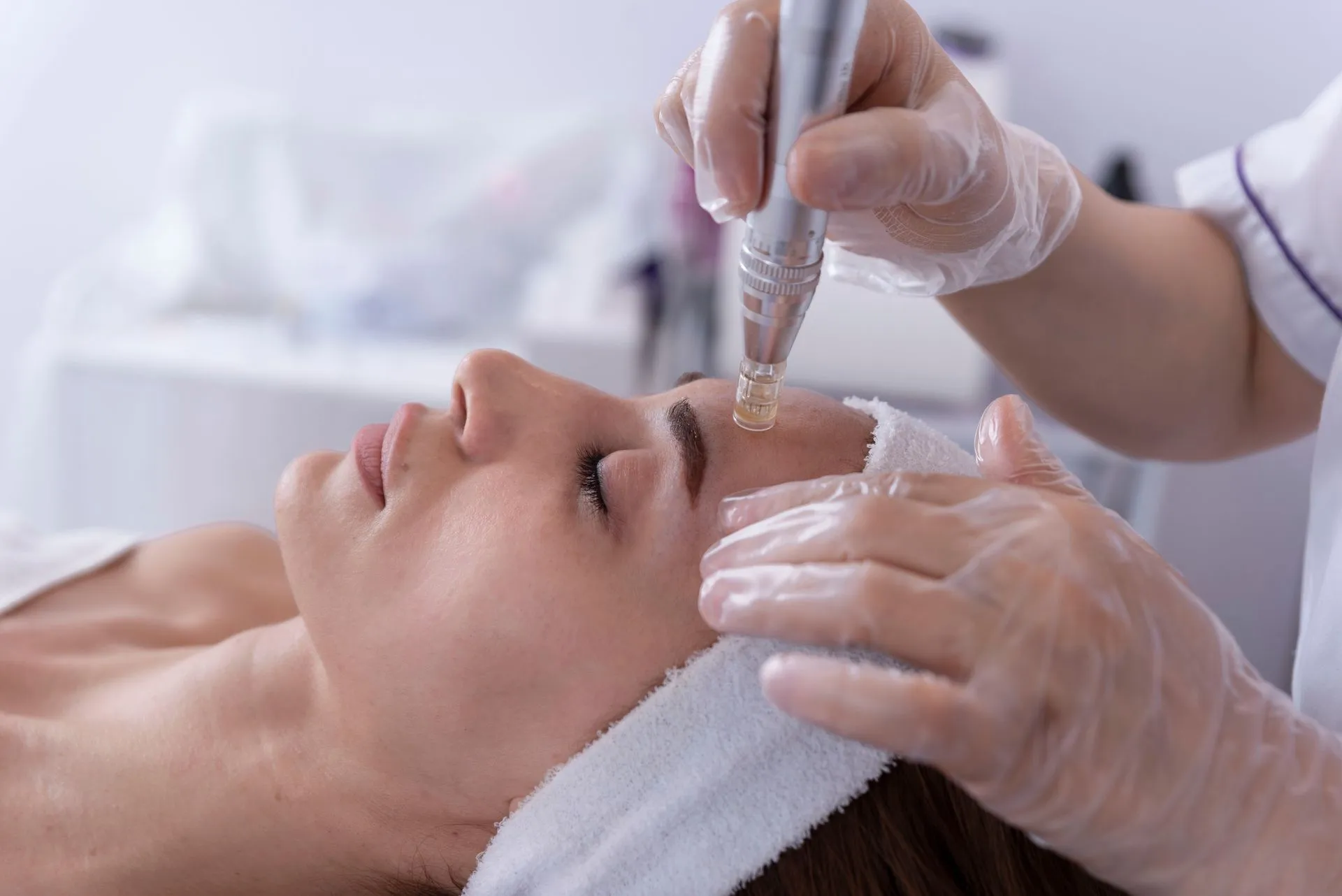 Microneedling-Kurs